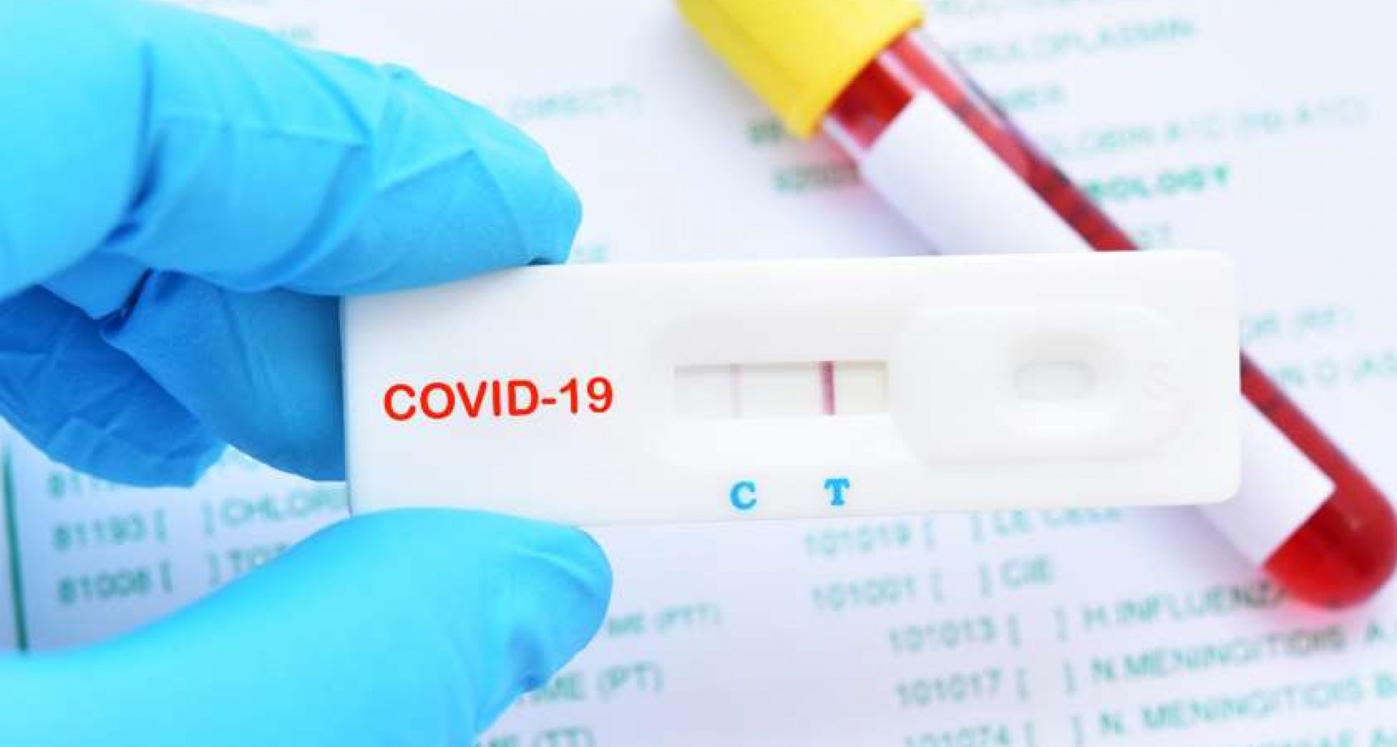 La OCV advierte de que la infrautilización de los laboratorios veterinarios paraliza millones de diagnósticos de coronavirus